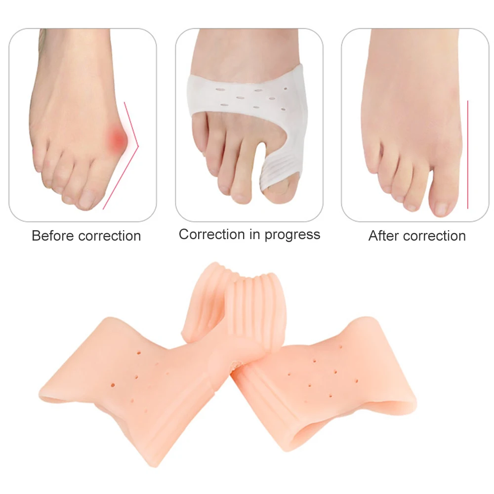 1 Pasang Bantuan Korektor Bunion Silikon, Pemisah Jempol Kaki Besar Pelurus Kaki untuk Hallux Valgus dan Jempol Kaki Besar Pereda Nyeri Sendi