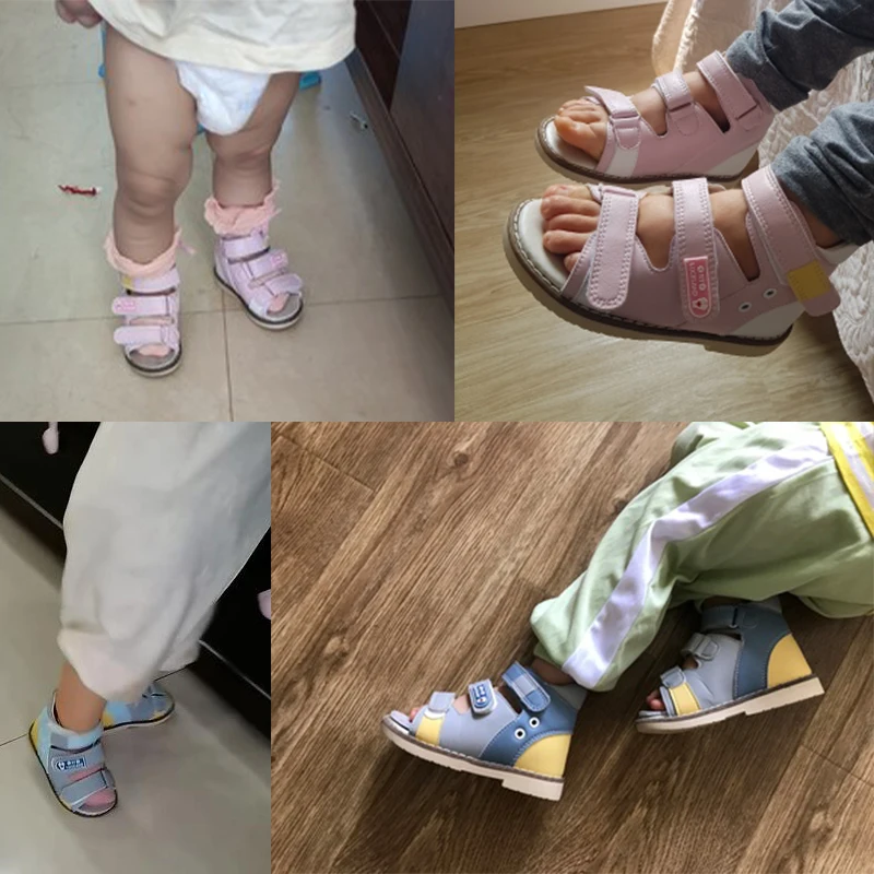 Sandalias para niños, zapatos ortopédicos de verano para niñas, calzado con soporte para arco de cuero Varus de pie plano para bebés de 1 a 8 años