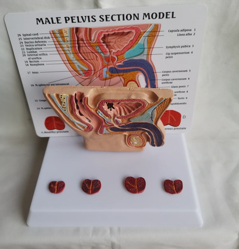 

Human Male pelvis section Abdominal Cavity Bladder Prostate Medical Teaching Model Health Illness Comparison Anatomical Model