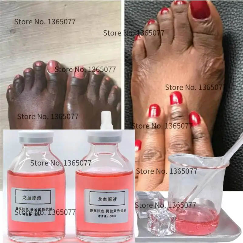 Skin Care Whitening Serum Natural Skin Care Permanent Bleaching Serums Lightening Kojic Acid Brightening 30ml
