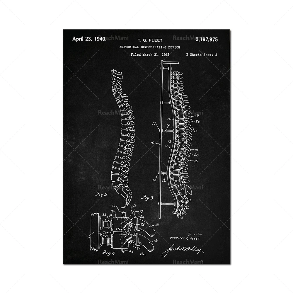 Human anatomy patent print, 1940 medical human spine art, medical equipment, human anatomy, doctor gift