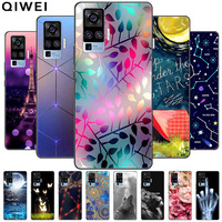 For Vivo X51 5G Case Soft TPU Silicone Back Cover for Vivo X50 Pro 5G X 50 X50Pro Phone Cases For VivoX51 X 51 2021 Fundas Coque