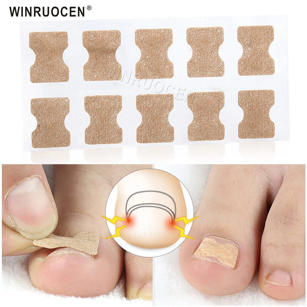 Ingrown Toenail Corrector Sticker Paronychia Treatment Fixer Recover Corrector Pedicure Foot Toe Nail Care Tool Glue Free