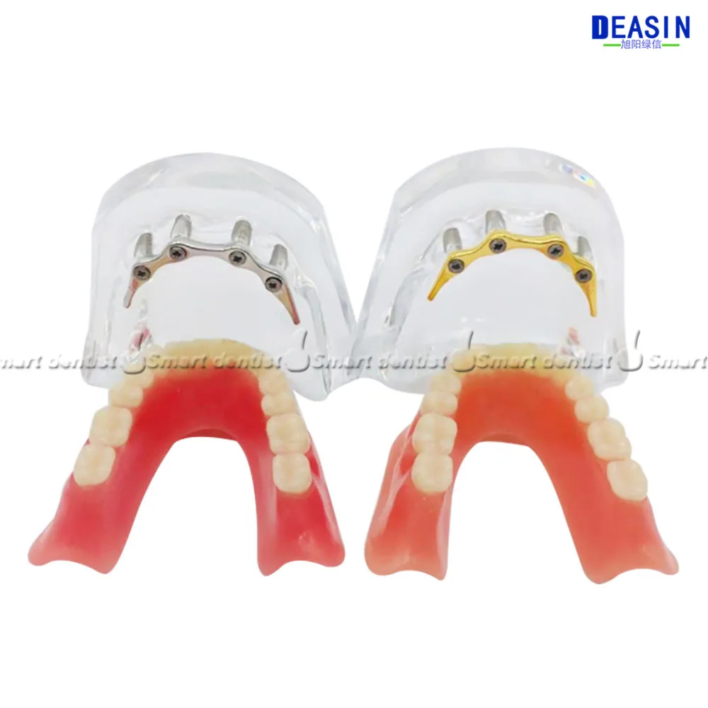 

1 pc x high quality Resin Coverage dental implant model dentures Removable teeth model for dentist study Deasin dentistry