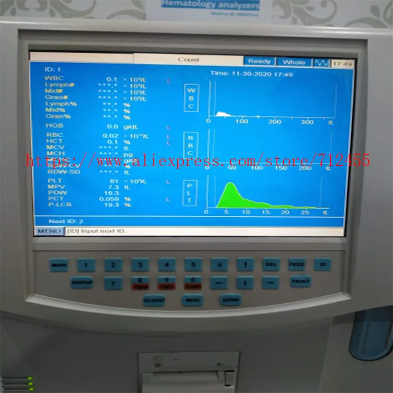 Imagem -02 - Tela de Lcd para Mindray Bc3000 Plus Cabos Ts104saalc01 Ts104saalc0100 10.4 Tela Lcd