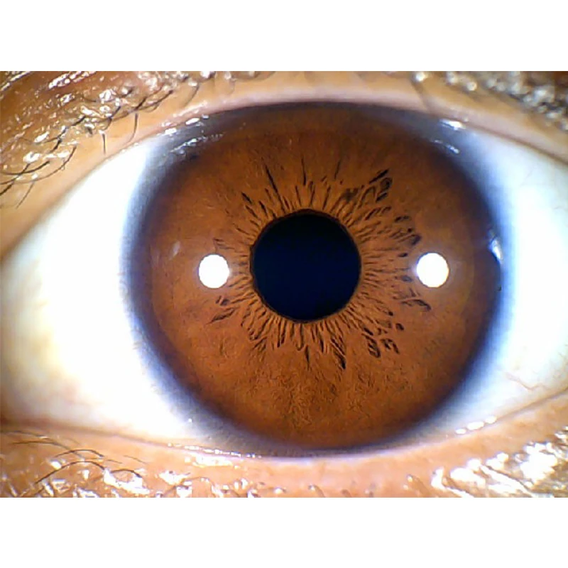 Miernik irysu z autofokusem DM9822U detektor irisa HD lupa irys USB komputerowy miernik irysu obraz może być zoomowany w USB2.0