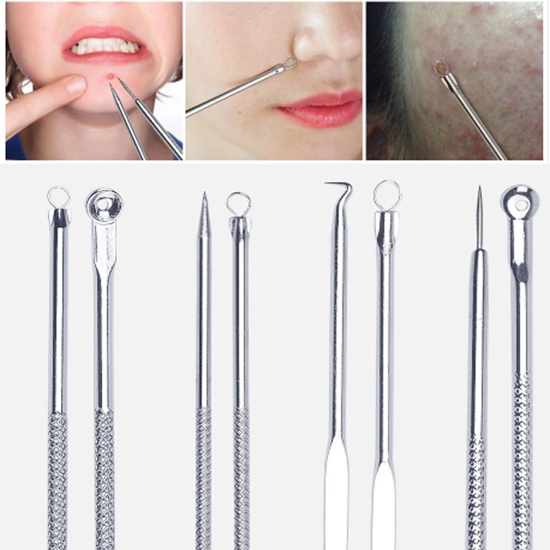 4 pçs agulha de acne cravo removedor espinha mancha comedone acne extractor removedor ferramenta conjunto poro cleaner rosto ferramentas limpeza