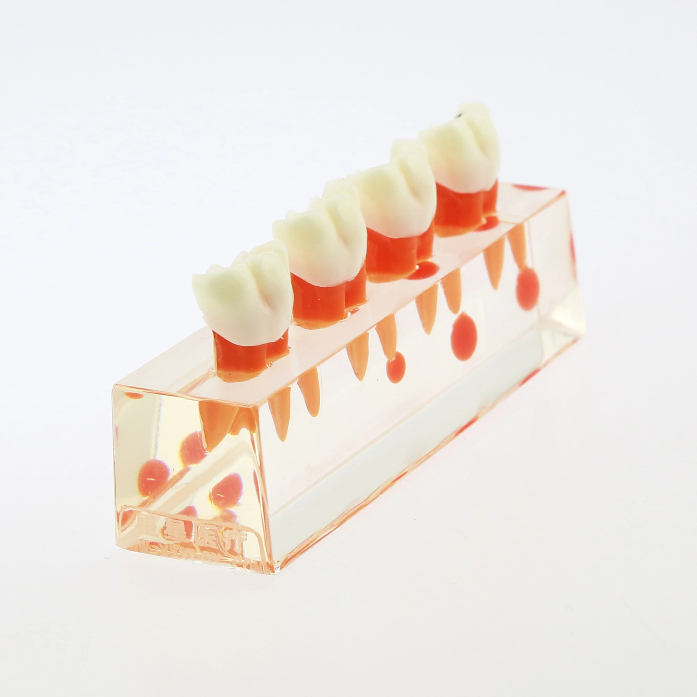 Dental Teeth Model 4-Stage Endodontic Treatment Clear Demonstrates Model for Study Teaching Clinic Decoration