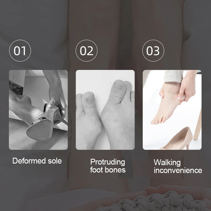 2pcs 5holes Silicone Gel Toe Separator Hallux Valgus Orthopedic Protector Thumb Corrector Spacers Bunion Relief Foot Care Tools