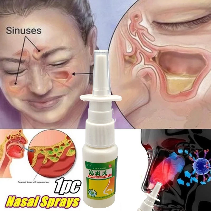 10pcs China Herbal Nose Spray Bi Shuang Ling Miao Nationality Essence Treat Rhinitis Clean Nose Protect Your Health