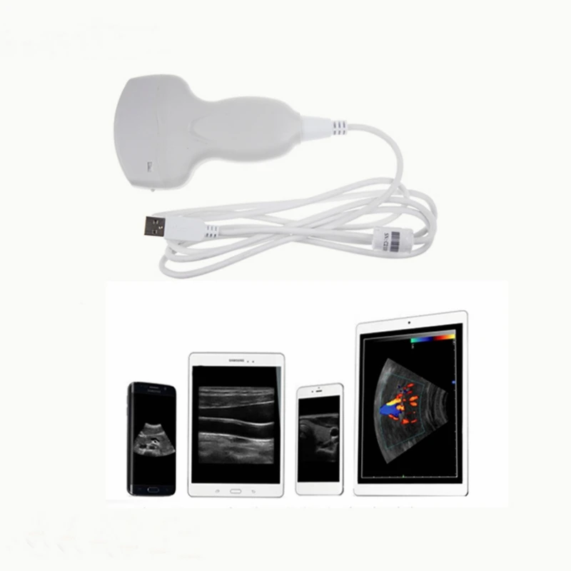 Cheapest portable color Doppler ultrasound machine/CE iPhone /Android connect wireless ultrasound machines Linear probe