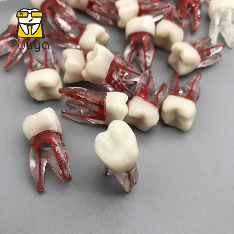 New  Dental Tooth Root Canal Model For RCT Practice Dentist Training Opening Of Pulp Chamber Therapy