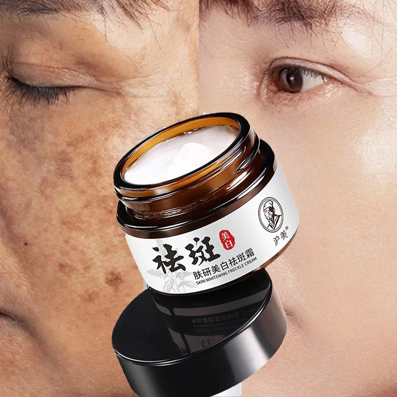

Мощный отбеливающий крем для лица, Китайский крем для удаления веснушек и темных пятен, 50 г, уход за кожей лица, отбеливающий крем
