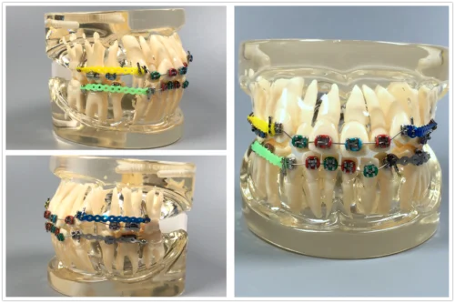 1pcs Clear Dental Study Model Orthodontic Demonstrate School Teaching Tool Crystal Translucent Ceramic Teaching Model