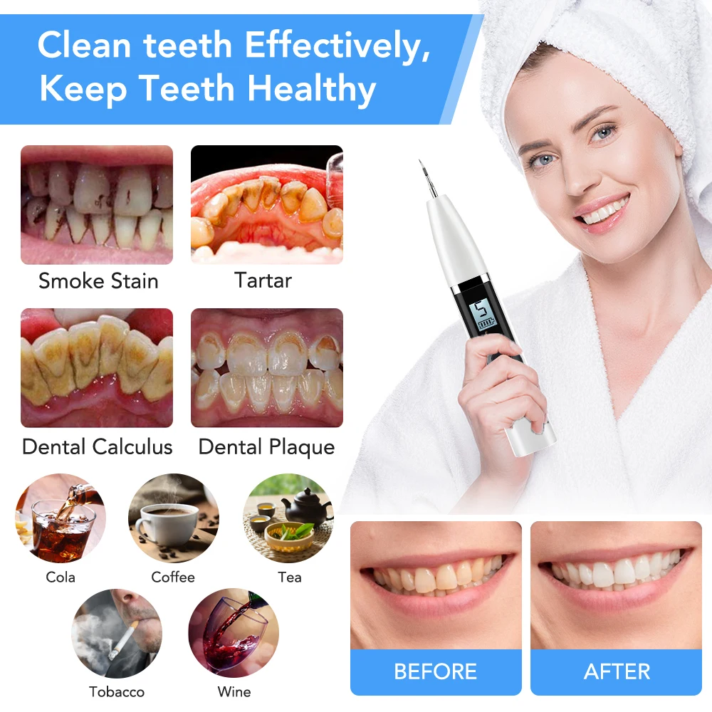 Détartreur dentaire électrique à ultrasons, pour le nettoyage des dents, blanchiment du calcul, dissolvant de tartre, taches de thé, nettoyage dentaire Oral sonique