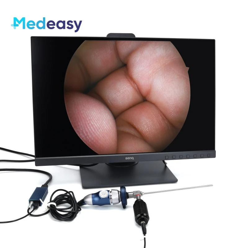 Portable Medical Endoscopy ENT Surgery USB Full HD 1080P HDMI Endoscope Camera with Free Light Source