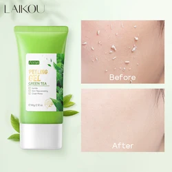 Facial Exfoliating Peeling Gel Face Scrub Moisturizing Whitening Green Tea Remove Blackhead Acne Detoxifies & Cleanses All Skin