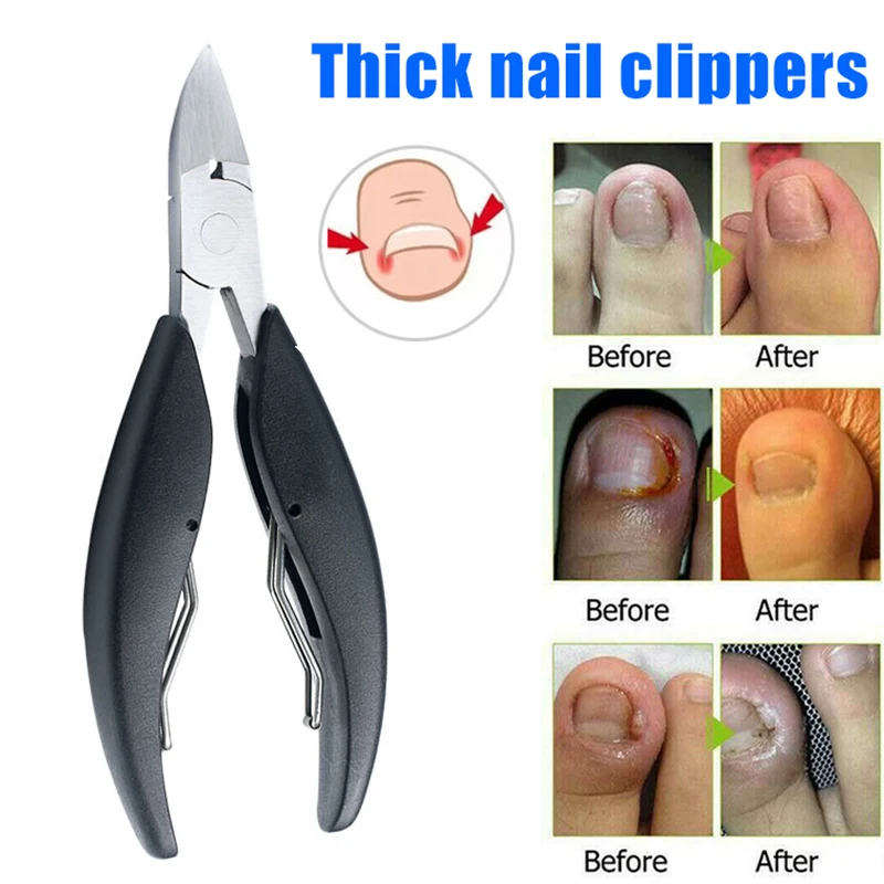 High Quality Toenail Clippers for Thick Ingrown Toe Nails Heavy Duty Nail Scissor Cut Toenails Tools Nail Art Tool