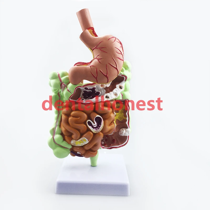 Human Digestive Stomach Anatomy Model Large Intestine Cecum Rectum  Teaching Supplies