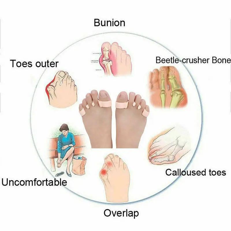 Chaussette de soin des pieds pour Hallux Valgus, pédicure, correcteur orthopédique, oignon, séparateur d\'orteils, redresseur des pieds