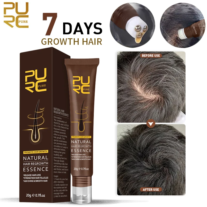 

PURC Ginger Fast Hair Growth Serums Prevent Hair Loss Products Scalp Treatments Hair Care Oil for Men Women