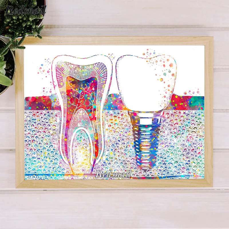 Tooth Implant Dentist Gift Dental Clinic Wall Decor Diy Diamond Painting Tooth Watercolor 5D Diamond Embroidery Mosaic EE738