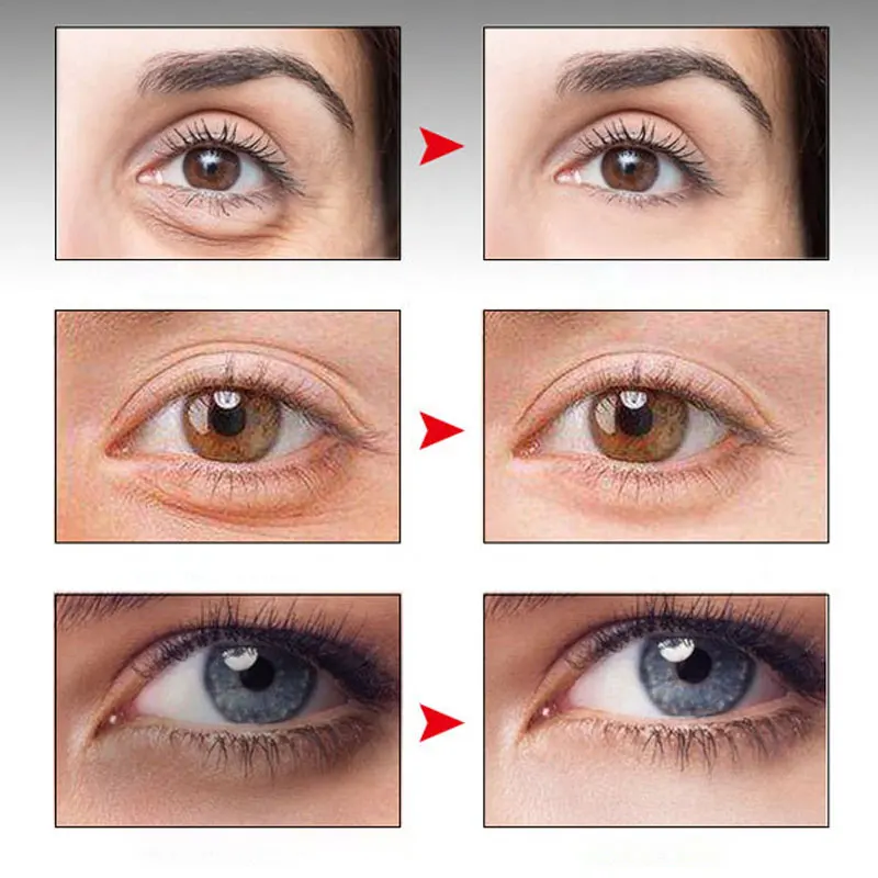 Eye Essence Fat-Removing Granules Dark Circles Moisturizing Whitening Reduce Edema Anti-Aging Fades Wrinkles Firm Lifting 20ml