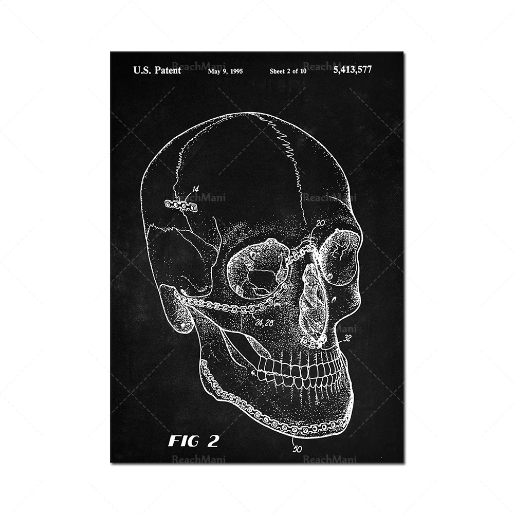 Anatomical skull patent print, skull poster, anatomy, body art, retro poster, doctor's office decoration