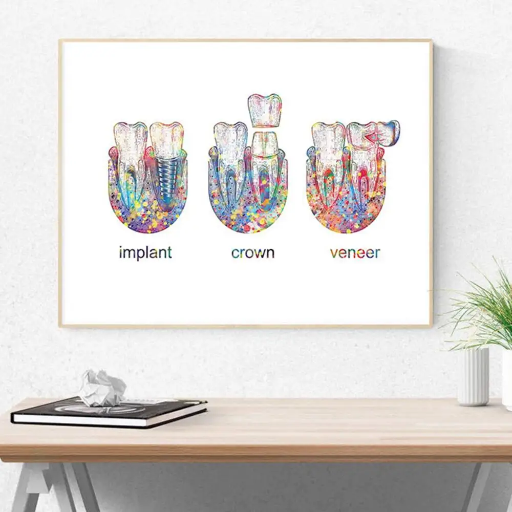 Tooth Implant Art Dental Crown Print Dentist Gift Tooth Anatomy Medical Wall Art Canvas Painting Picture Dental Clinic Decor