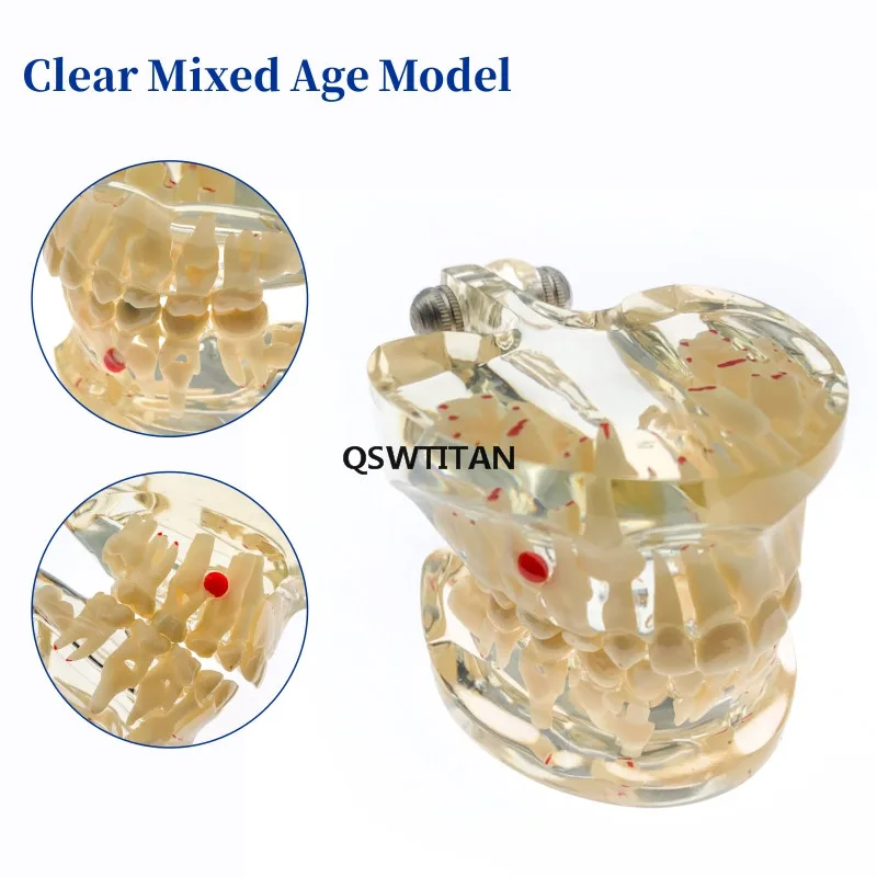 Teeth Model Transparent Adult /Children Pathological Teeth Model Doctor-Patient Teaching