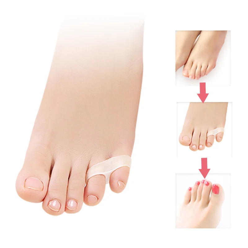 1-10 Pair Toe Separator-Interdigital-Corrector-Silicone-Guard Foot-Finger-Care-Tools-Bunion Straightener-Pedicure-Orthopedic