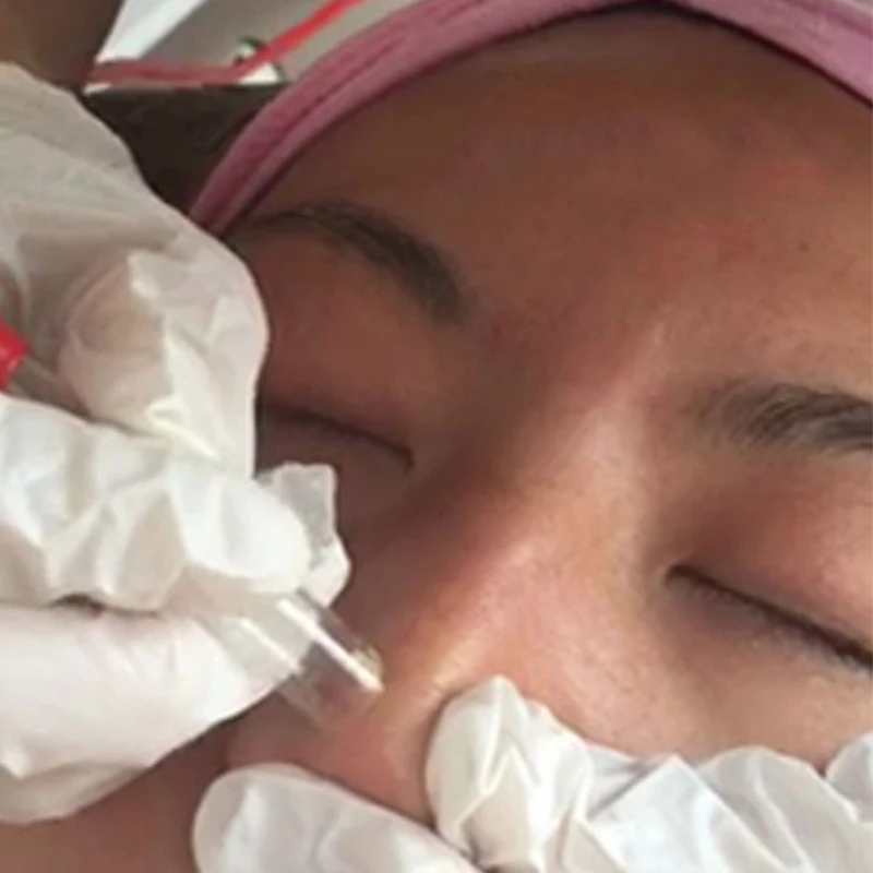 Устройство для всасывания угрей Устройство для всасывания смазки для лица Чистка пор, кислородный измеритель, пополняющая вода H3201