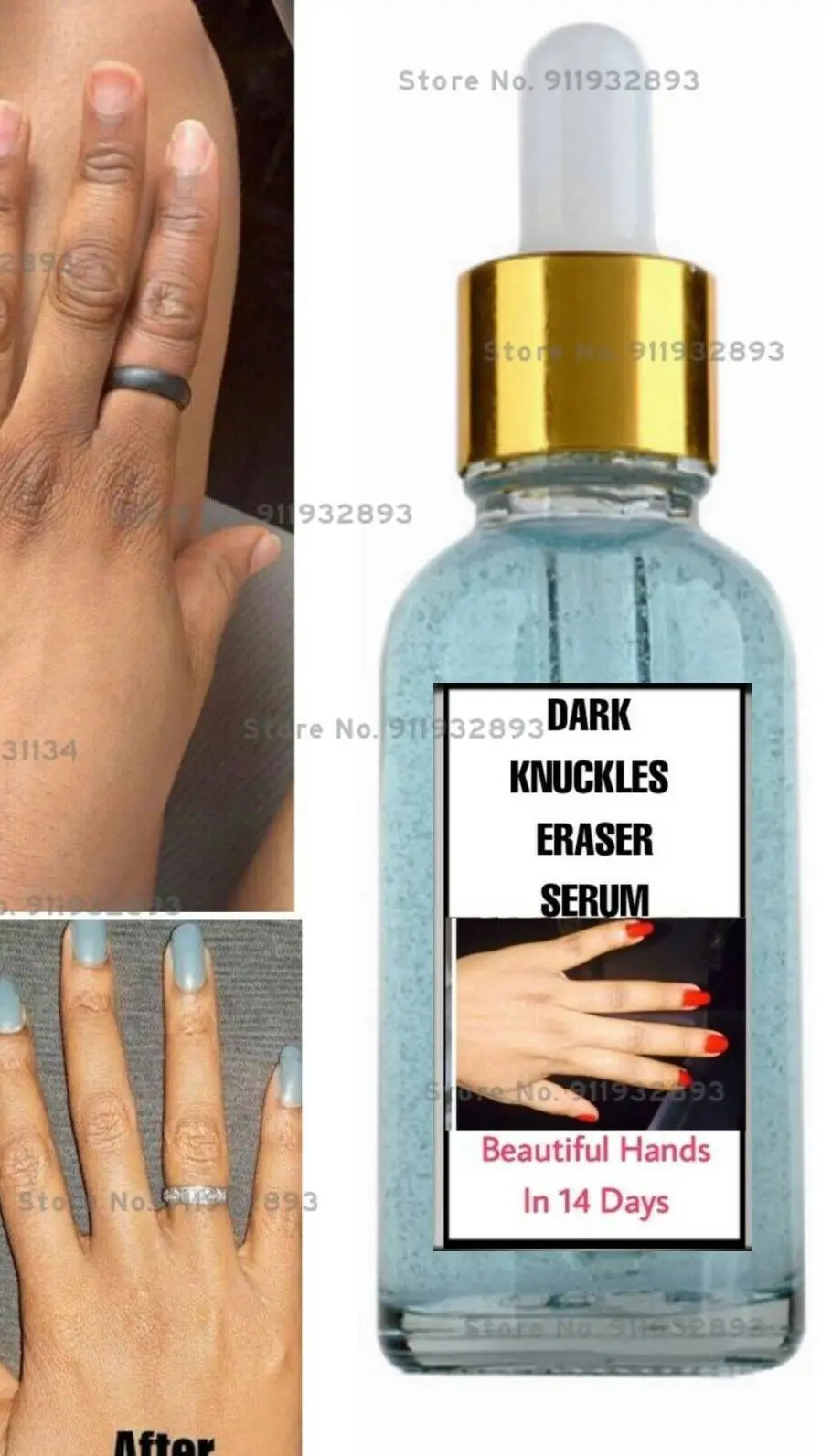 

Knuckles Remover Serum, Fast Effective Knuckles Eraser, IntenseDark Spots Serum