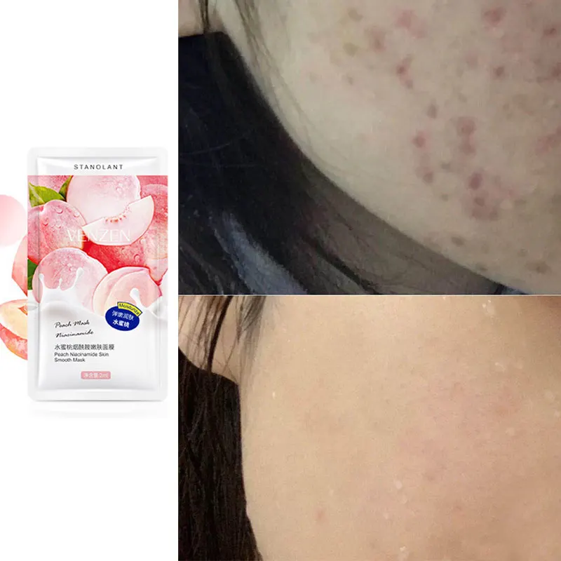 Máscara de niacinamida melocotón para dormir, mascarilla Facial hidratante desechable para cepillar los poros, reafirmante y brillante para la piel,