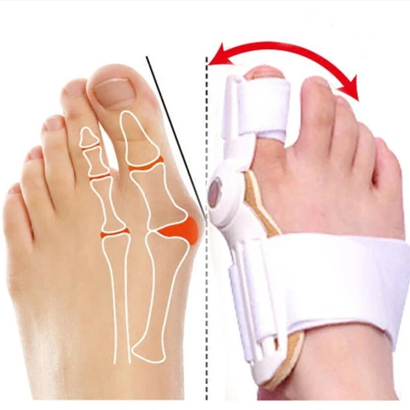 1PC Big Bone Toe Bunion Splint Straightener Corrector Toe Separator Toe Protector Relief Hallux Valgus Both Left Right Feet Used