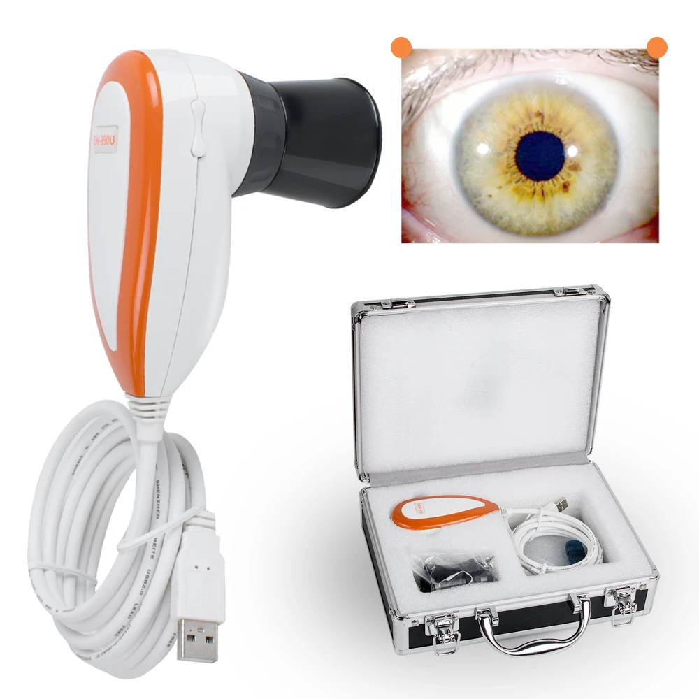 

5.0MP Iriscope Iris camera Analyzer Iridology USB camera with pro Iris Software