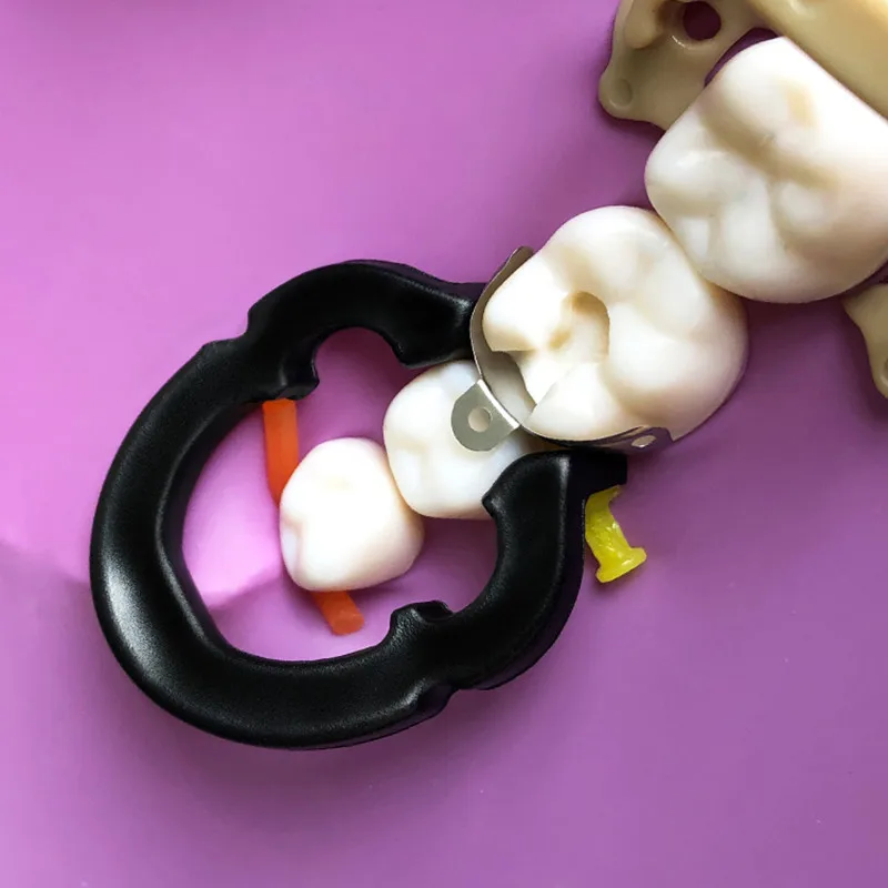 Sistema de matriz seccional Dental, bandas de matriz de Metal contorneadas seccionales, anillo de sujeción de resina, alicates dentales,