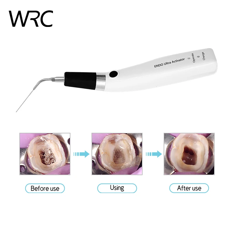 Wysokowydajna stomatologiczna bezprzewodowa operacja ultradźwiękowa aktywator ultradźwiękowy Endo aktywator endodontyczny