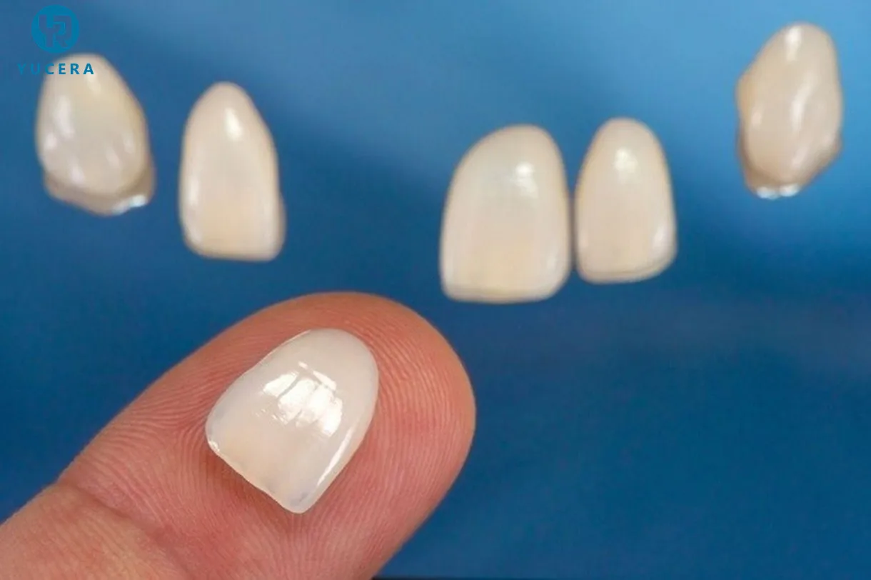 

Dental lab Veneers Immediate Aesthetic Restoration following CE/ISO standard Press Lithium Disilicatefor