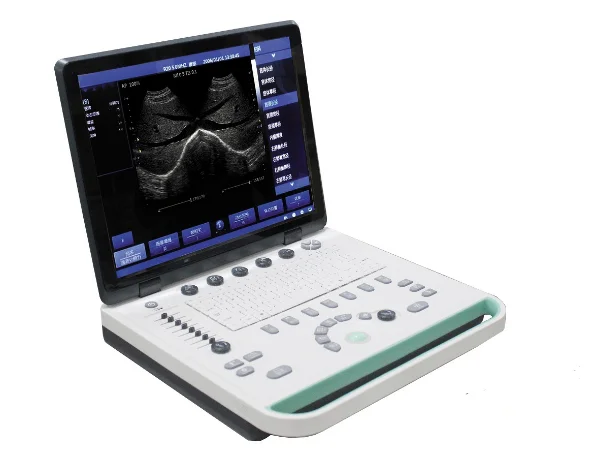 O super preto e branco portátil de b, cabeça convexa da ponta de prova da disposição de 3.5mhz, pode ser equipado com a ponta de prova do ultrassom de 6.5mhz yin