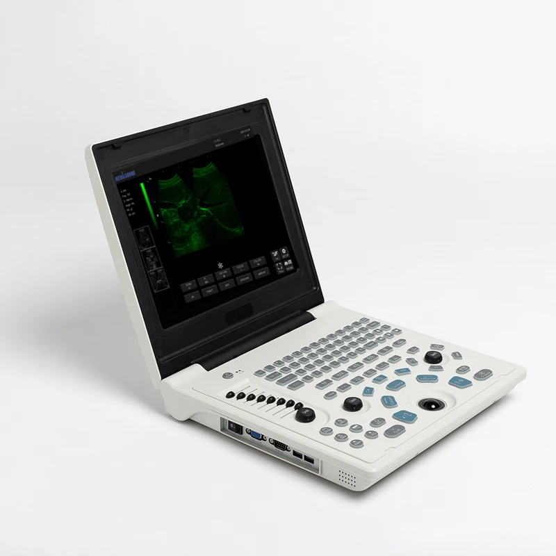 12 Inch LED Screen Notebook Ultrasound USG Scanner