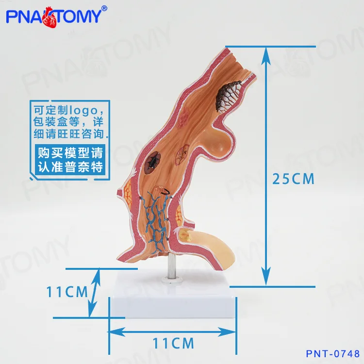 1:1 Life-sized Human  Pathological Esophagus Anatomical Model Digestive System Stomach Respiratory Organs Digestive Structure