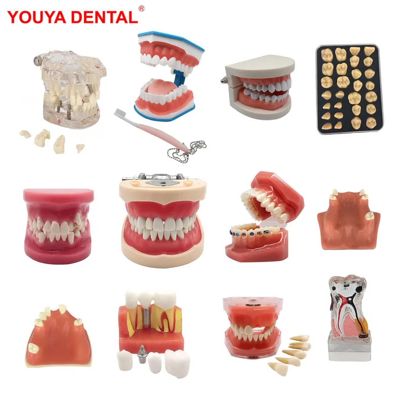 2022 Various Dental Model Teeth Teaching Model Study Removable Orthodontic Implant Tooth Models Resin Dentistry Dentist Material