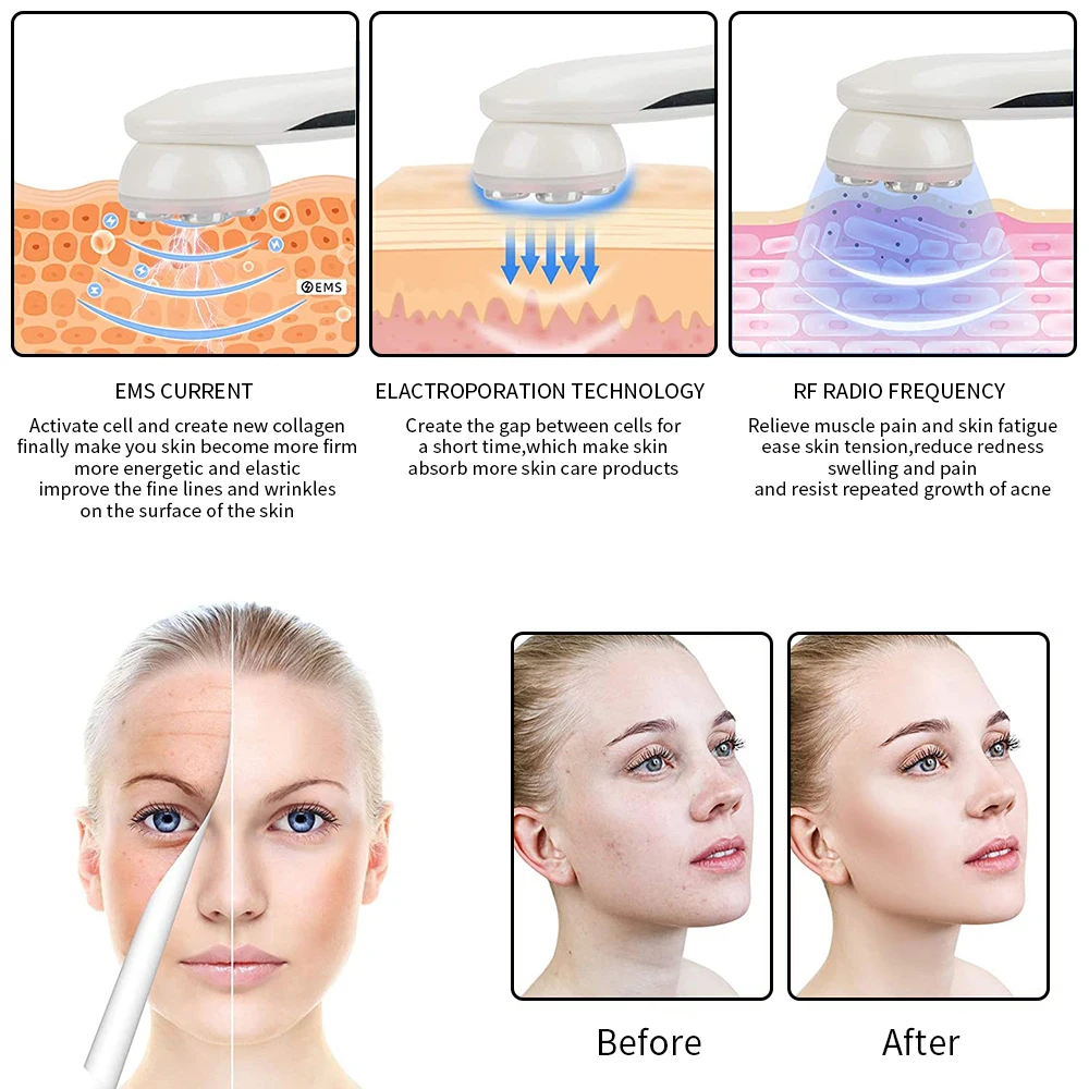 Mesotherapy Electroporation RF Radio Frequency Facial LED Photon Skin Care Beauty Device Face Lifting Tighten Wrinkle Removal