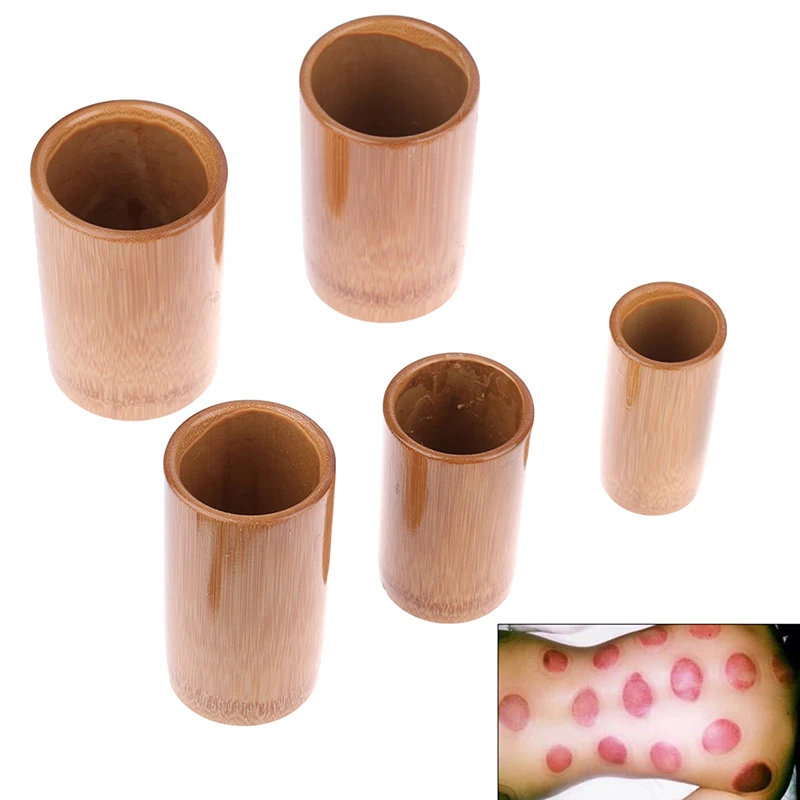 

Traditional Chinese Jar Fire Cupping Set Body Therapy Cellulite Kit Carbonized Bamboo Suction Cups Acupuncture Massage