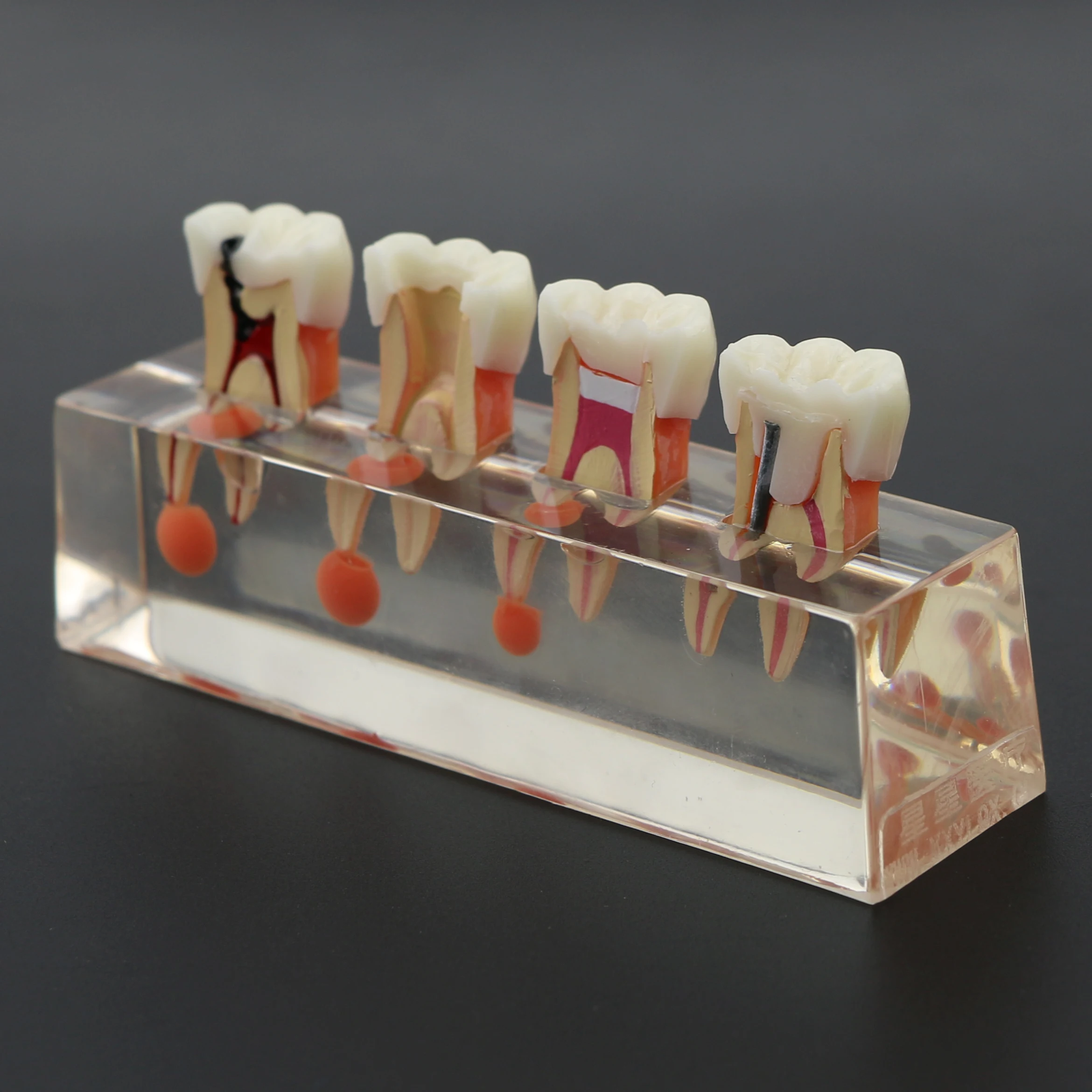 Dental Teeth Model 4-Stage Endodontic Treatment Clear Demonstrates Model for Study Teaching Clinic Decoration