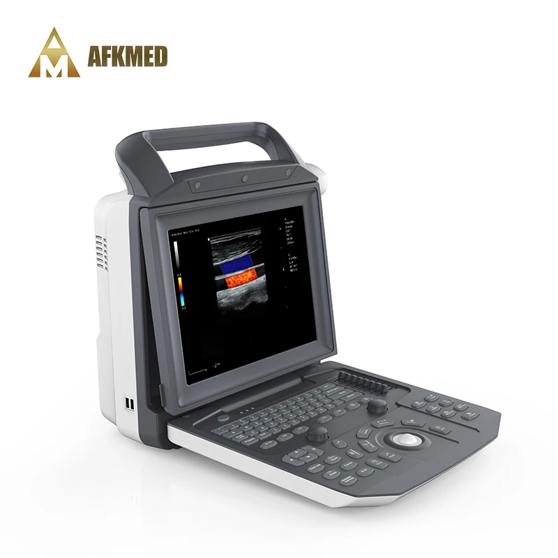 Op Verkoop Factory Aangepaste Draagbare Kleur Doppler Medische Echografie Instrumenten Ultrasound Machines