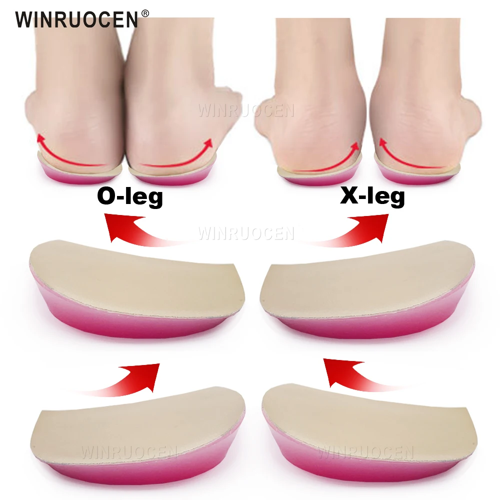 WINRUOCEN X/O-type Legs Orthopedic Insoles Silicone  Corrector Gel Shoe Inserts For Heel Knee Pain Bow Legs Valgus Varus Pad