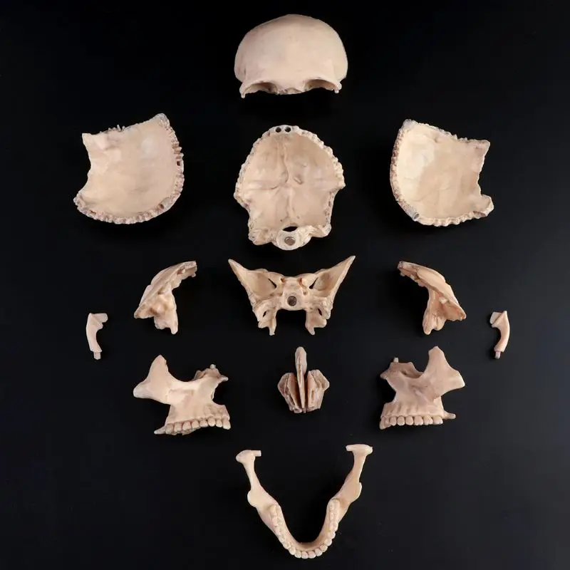 15pcs/set 4D Disassembled Color Skull Anatomical Model Detachable Medical Teaching Tool