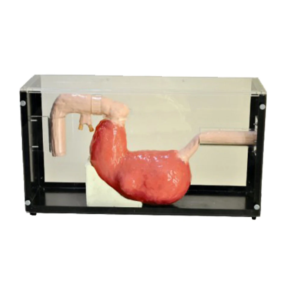 

Gastroscopy Trainer Model Esophagoscope Training and Demonstration Model